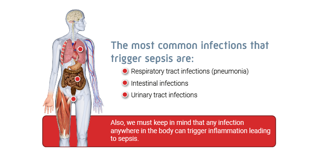 Most common infections that trigger sepsis